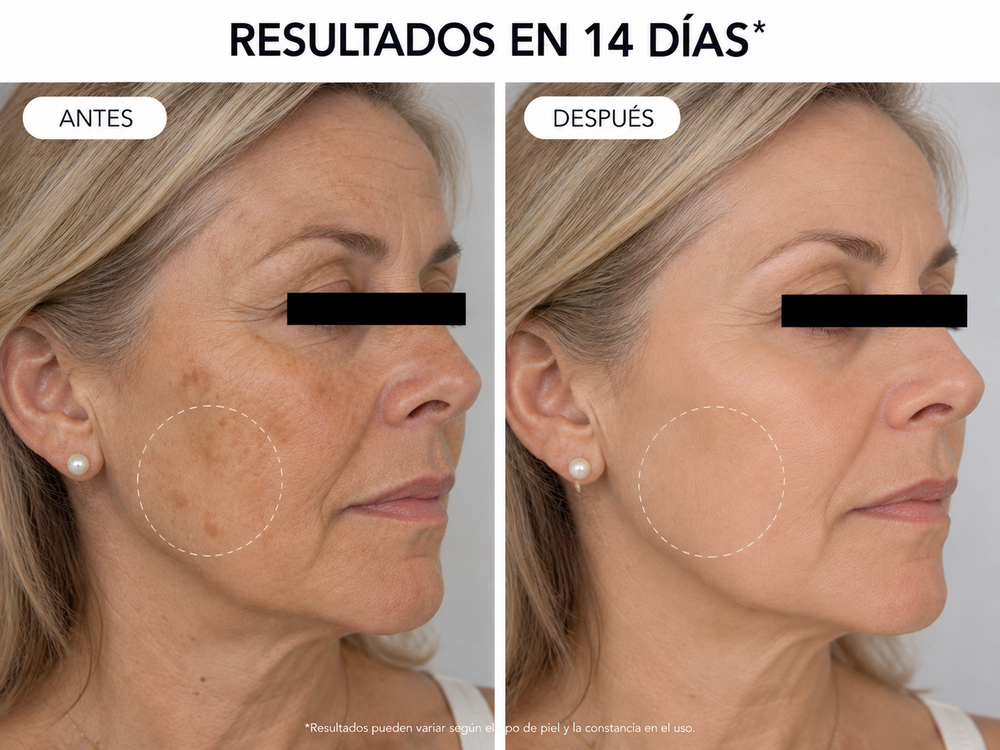 Clienta utilizando Luméra por la noche