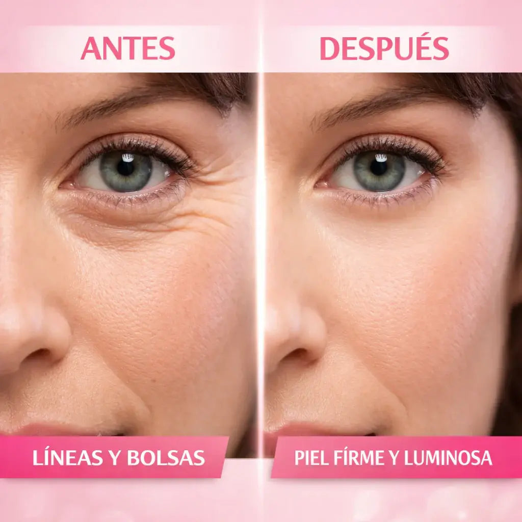 Luméra EyeLift™